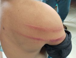 Insiden Penyerangan terhadap Petugas Keamanan PTPN IV Kebun Silau Dunia, Penanganan Kasus Jadi Perhatian