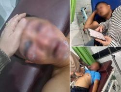 Diduga Berawal dari Transaksi Mobil, Warga Laporkan Dugaan Pengeroyokan ke Polda Sumut