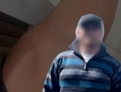 Diduga Dianiaya dan Dipaksa Transfer Uang, ES Laporkan Pria ke Polrestabes Medan